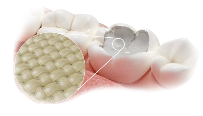 Fibrafill dentin and flow composites for dental restorations, superior handling, performance, fracture resistance.