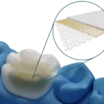 Rinforzo per il restauro in laboratorio Dentapreg® VEIL