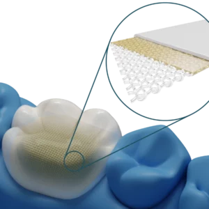 Rinforzo per il restauro in laboratorio Dentapreg® VEIL