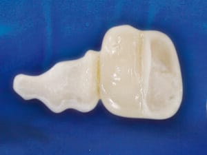 Dentapreg® BUNDLE Case