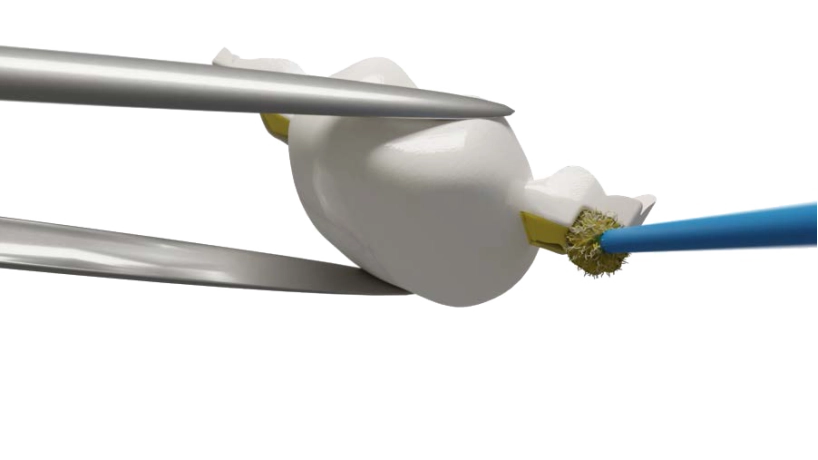 Dentapreg® BUNDLE preparato per l'applicazione sul modello dentale con gli strumenti.