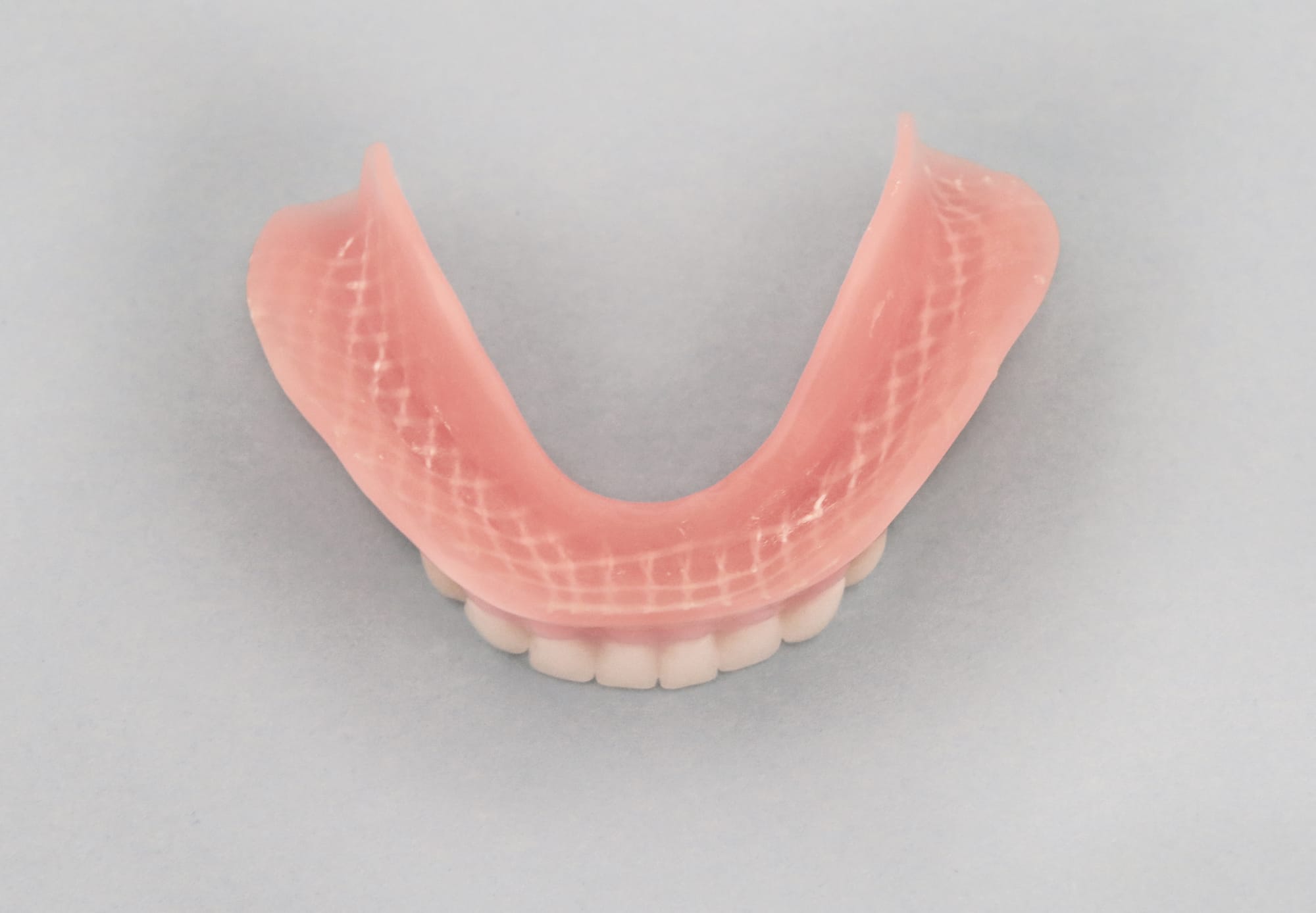 Dentapreg® MESH reinforced lower jaw denture for enhanced durability.
