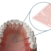 Dentapreg® MESH Prothesenverstärkung