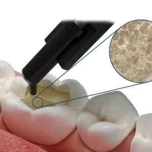 Fibrafill® DENTIN Materiale bulk-fill con fibre corti