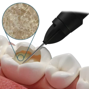 Fibrafill® FLOW Composito fluido con fibre corti
