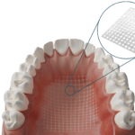 Dentapreg Mesh_02 Dentapreg® MESH Transparent